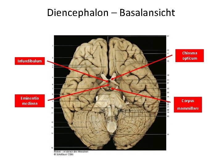 Diencephalon – Basalansicht Infundibulum Eminentia mediana Chiasma opticum Corpus mammillare 