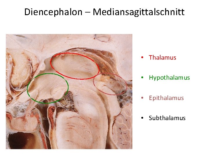 Diencephalon – Mediansagittalschnitt • Thalamus • Hypothalamus • Epithalamus • Subthalamus 