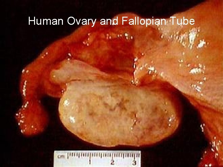 Human Ovary and Fallopian Tube 