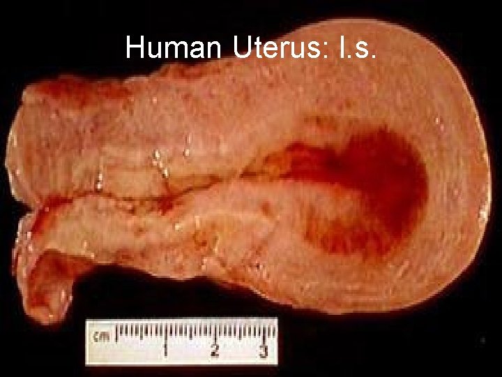 Human Uterus: l. s. 
