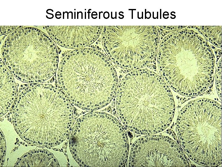 Seminiferous Tubules 