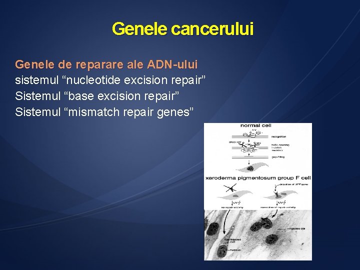 Genele cancerului Genele de reparare ale ADN-ului sistemul “nucleotide excision repair” Sistemul “base excision