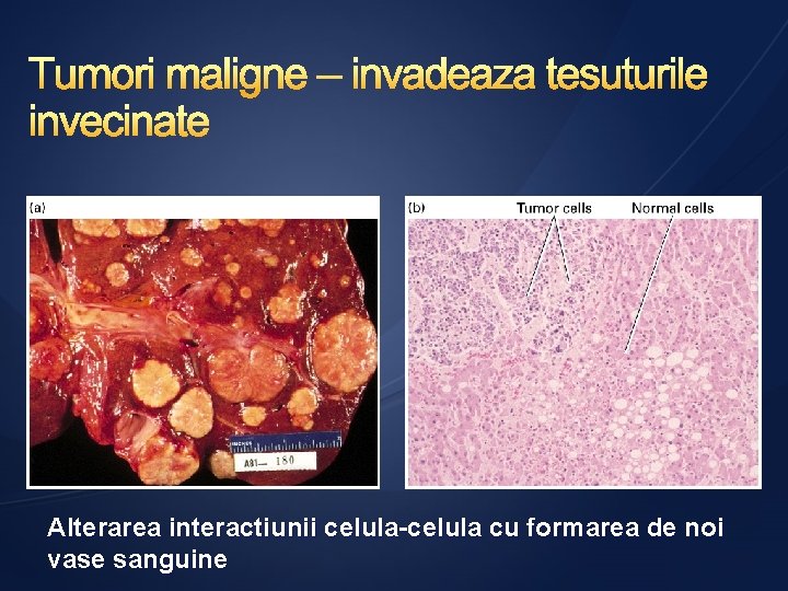 Alterarea interactiunii celula-celula cu formarea de noi vase sanguine 