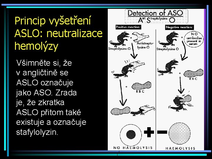 Princip vyšetření ASLO: neutralizace hemolýzy Všimněte si, že v. angličtině se ASLO označuje jako