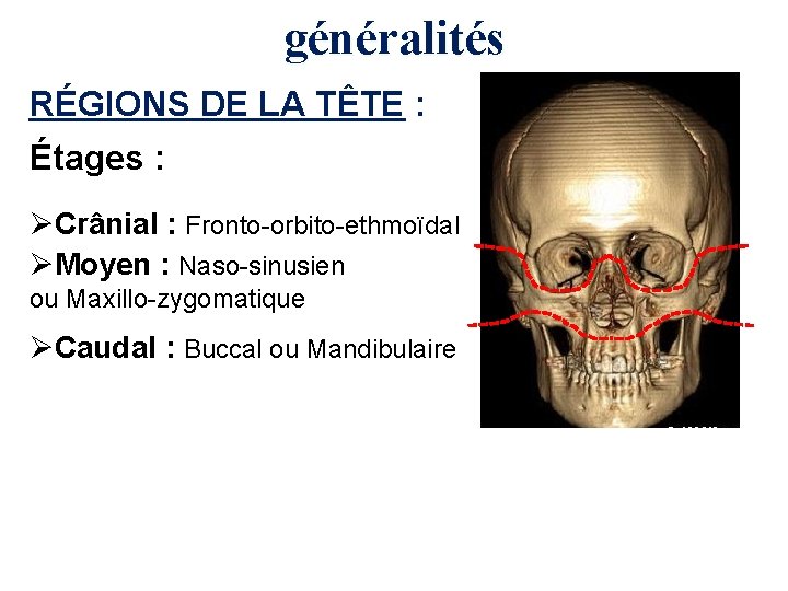 généralités RÉGIONS DE LA TÊTE : Étages : ØCrânial : Fronto-orbito-ethmoïdal ØMoyen : Naso-sinusien