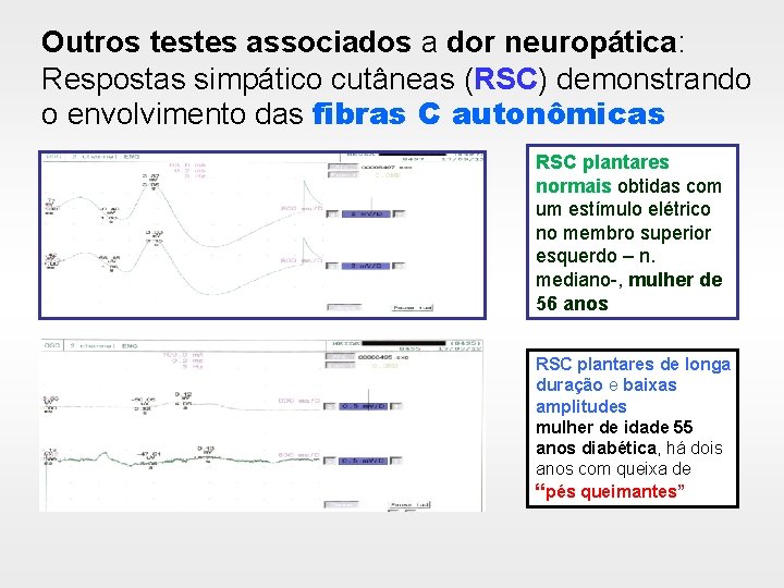 Outros testes associados a dor neuropática: Respostas simpático cutâneas (RSC) demonstrando o envolvimento das