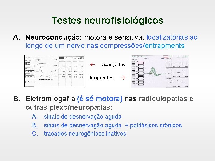 Testes neurofisiológicos A. Neurocondução: motora e sensitiva: localizatórias ao longo de um nervo nas