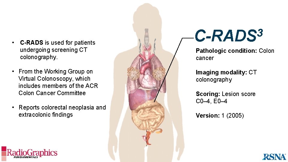  • C-RADS is used for patients undergoing screening CT colonography. • From the