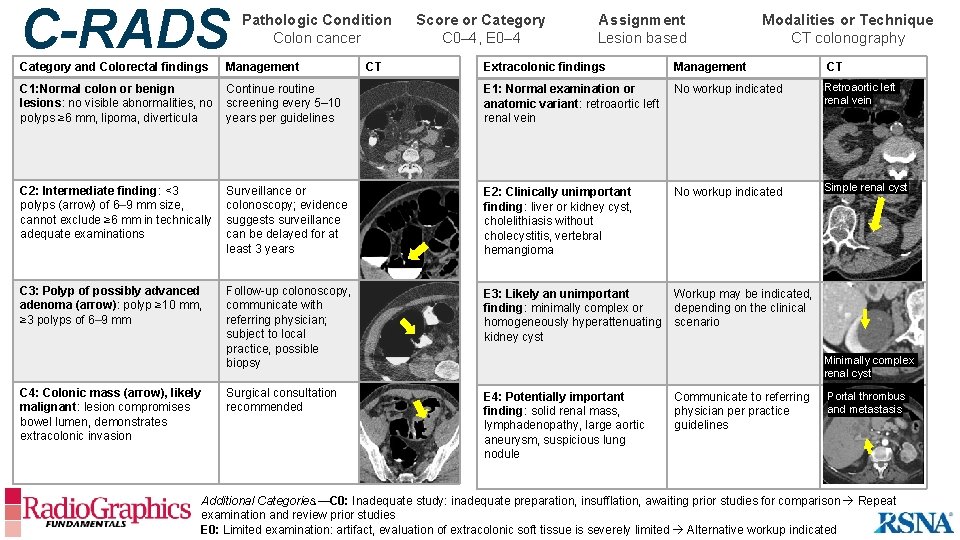 C-RADS Pathologic Condition Colon cancer Score or Category C 0– 4, E 0– 4