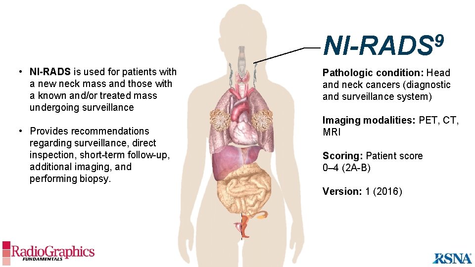 9 NI-RADS • NI-RADS is used for patients with a new neck mass and