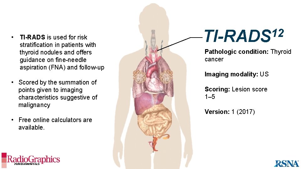  • TI-RADS is used for risk stratification in patients with thyroid nodules and