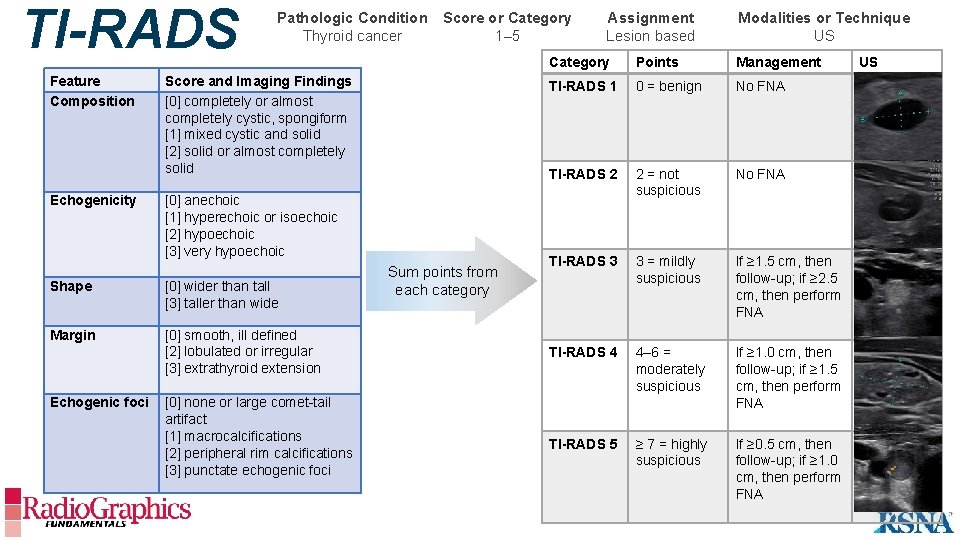 TI-RADS Feature Composition Echogenicity Pathologic Condition Score or Category Thyroid cancer 1– 5 Score