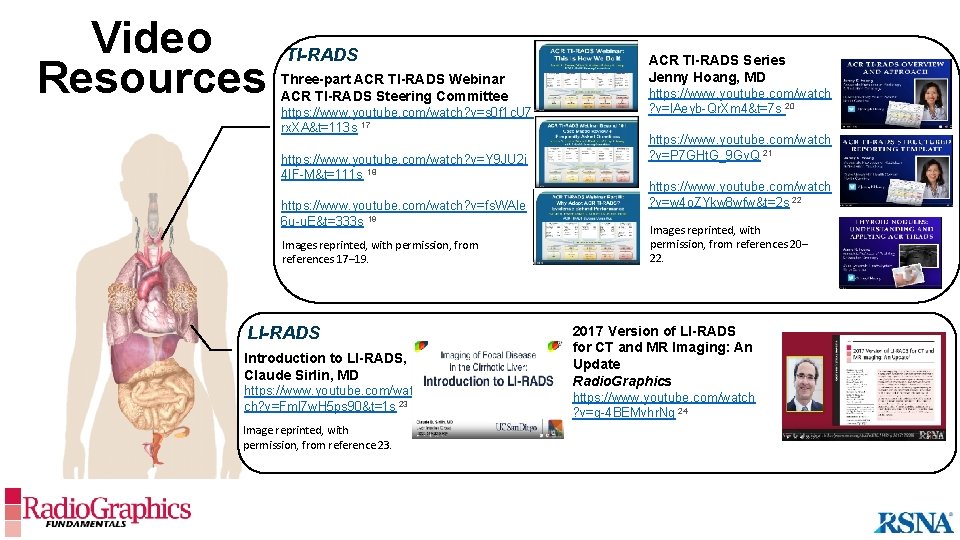 Video Resources TI-RADS Three-part ACR TI-RADS Webinar ACR TI-RADS Steering Committee https: //www. youtube.