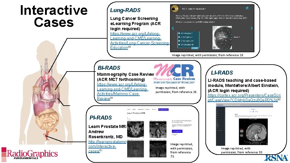 Interactive Cases Lung-RADS Lung Cancer Screening e. Learning Program (ACR login required) https: //www.