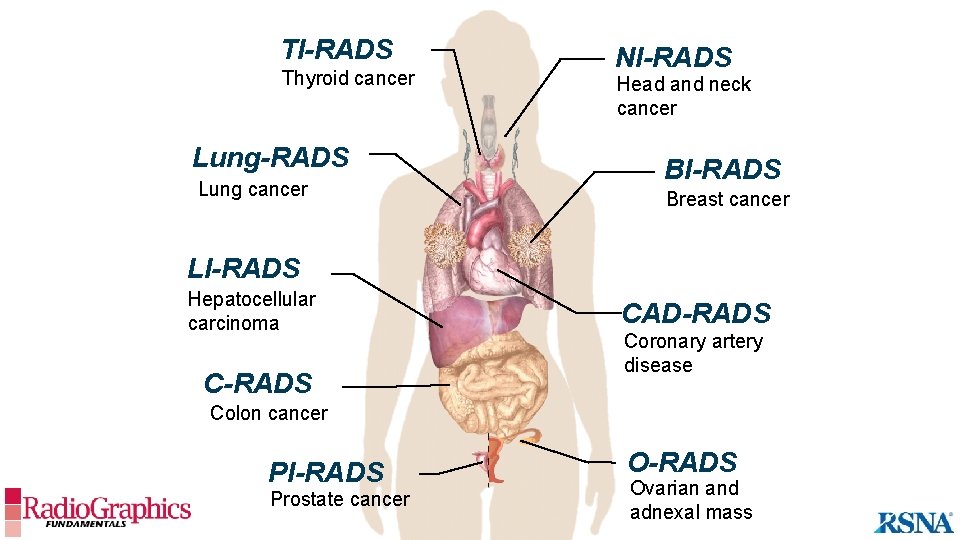 TI-RADS Thyroid cancer Lung-RADS Lung cancer NI-RADS Head and neck cancer BI-RADS Breast cancer