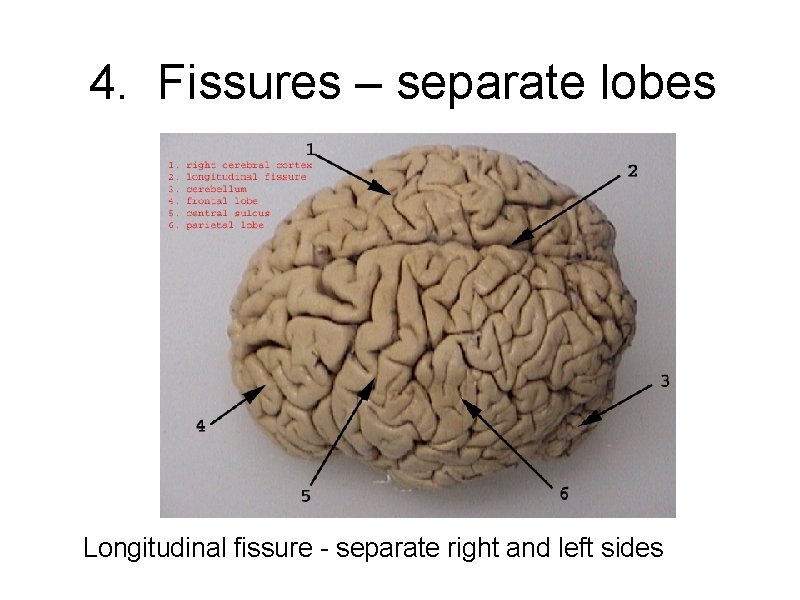 4. Fissures – separate lobes Longitudinal fissure - separate right and left sides 