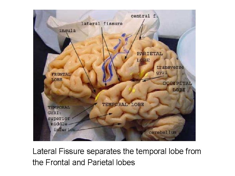 Lateral Fissure separates the temporal lobe from the Frontal and Parietal lobes 