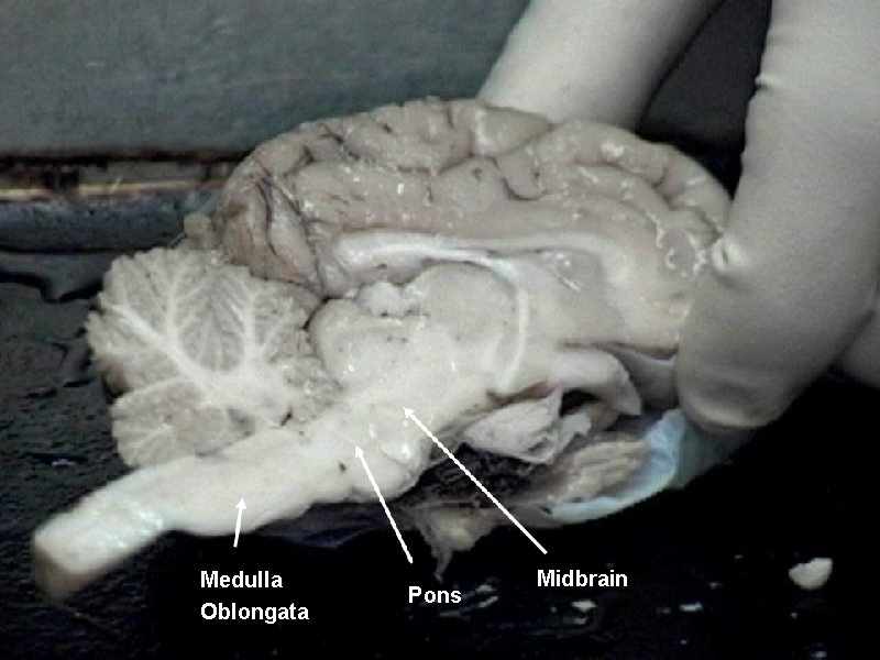 Medulla Oblongata Pons Midbrain 