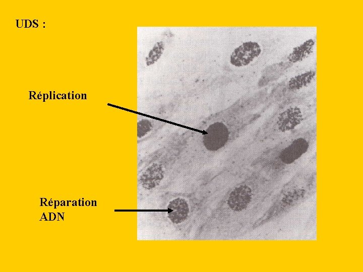 UDS : Réplication Réparation ADN 