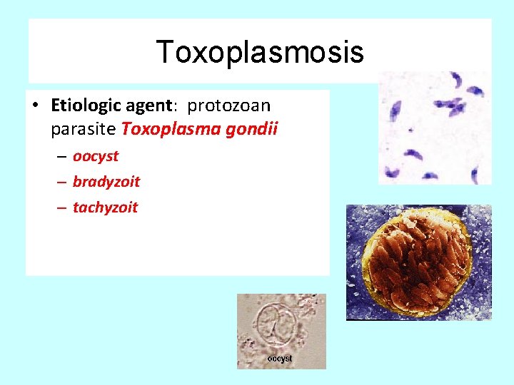 Toxoplasmosis • Etiologic agent: protozoan parasite Toxoplasma gondii – oocyst – bradyzoit – tachyzoit