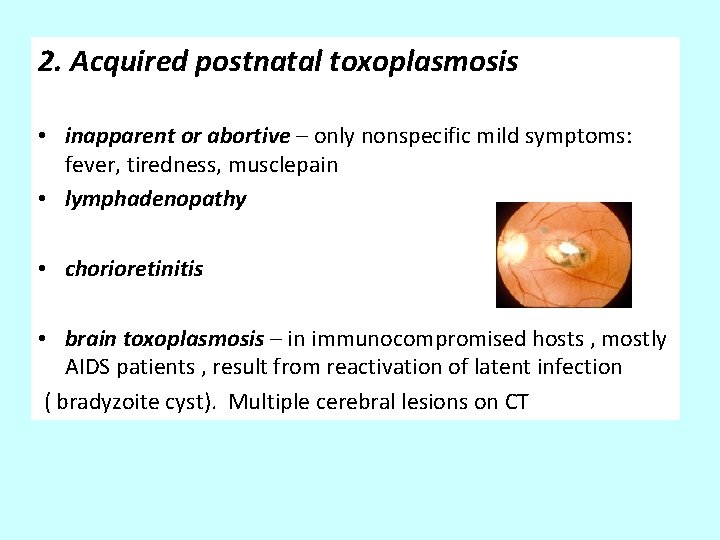 2. Acquired postnatal toxoplasmosis • inapparent or abortive – only nonspecific mild symptoms: fever,