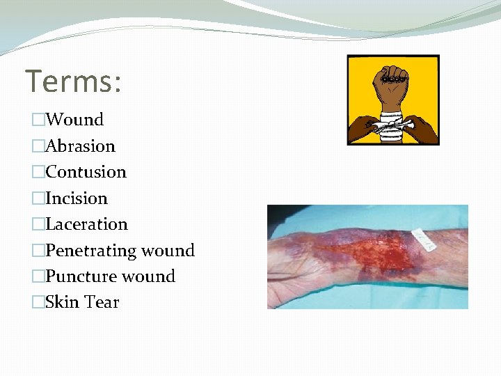 Terms: �Wound �Abrasion �Contusion �Incision �Laceration �Penetrating wound �Puncture wound �Skin Tear 