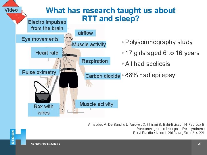 Video What has research taught us about RTT and sleep? Electro impulses from the