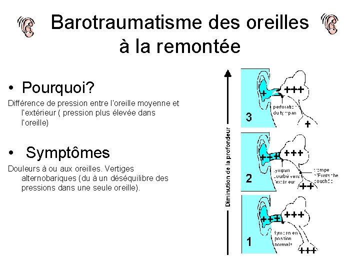 Barotraumatisme des oreilles à la remontée • Pourquoi? Différence de pression entre l’oreille moyenne