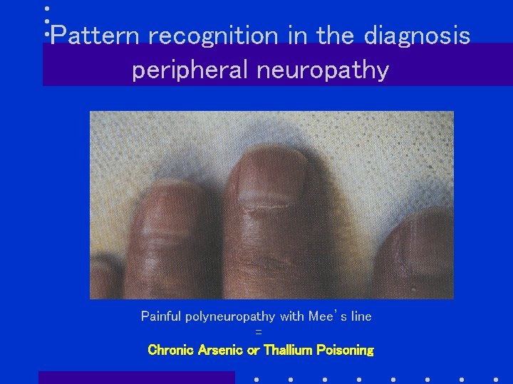 Pattern recognition in the diagnosis peripheral neuropathy Painful polyneuropathy with Mee’s line = Chronic