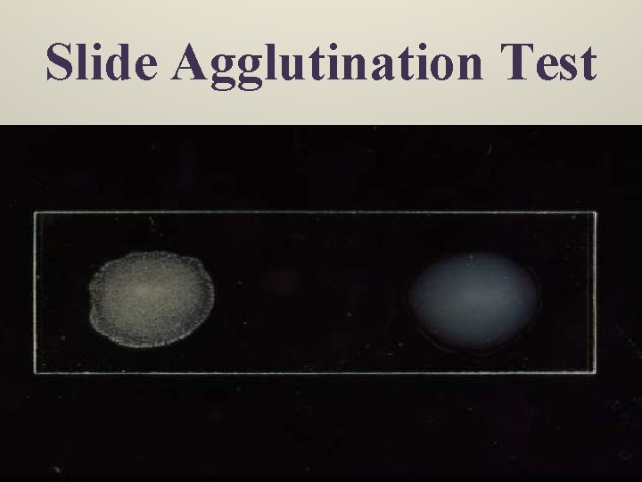 Slide Agglutination Test 6/8/2021 Dr. T. V. Rao MD 19 
