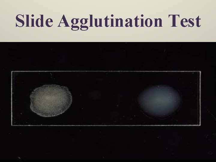 Slide Agglutination Test 6/8/2021 Dr. T. V. Rao MD 19 