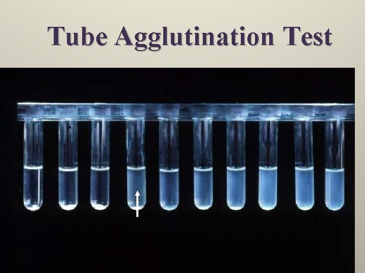 Tube Agglutination Test 6/8/2021 Dr. T. V. Rao MD 21 