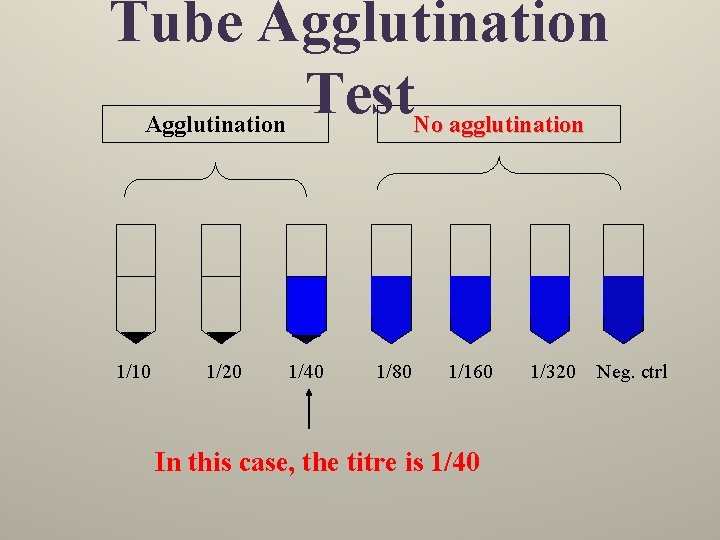 Tube Agglutination Test Agglutination 1/10 1/20 No agglutination 1/40 1/80 1/160 In this case,