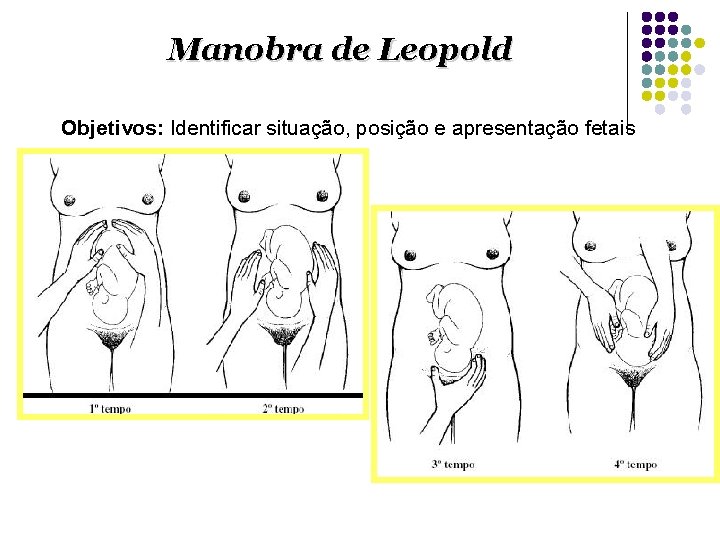 Manobra de Leopold Objetivos: Identificar situação, posição e apresentação fetais 