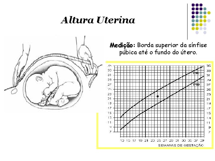 Altura Uterina Medição: Borda superior da sínfise púbica até o fundo do útero. 