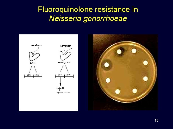 Fluoroquinolone resistance in Neisseria gonorrhoeae 18 