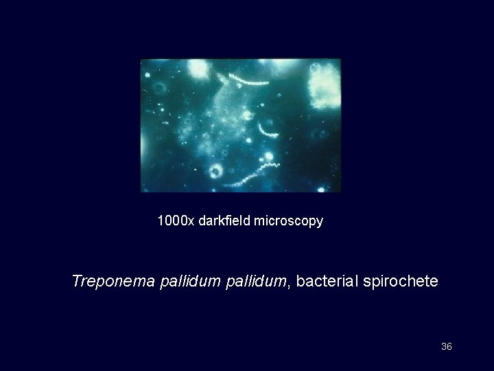 1000 x darkfield microscopy Treponema pallidum, bacterial spirochete 36 