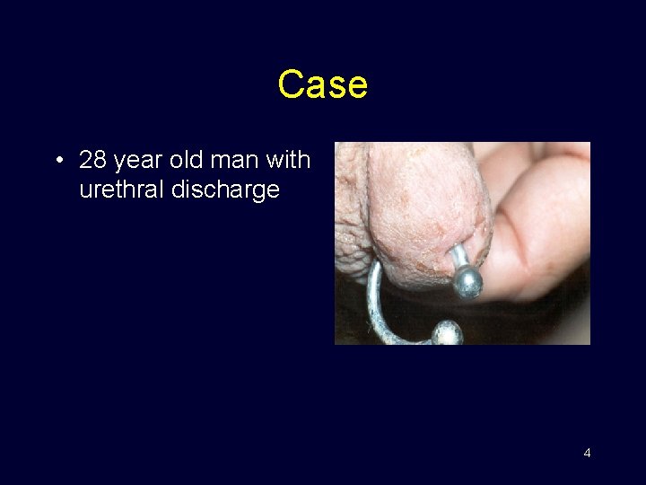 Case • 28 year old man with urethral discharge 4 