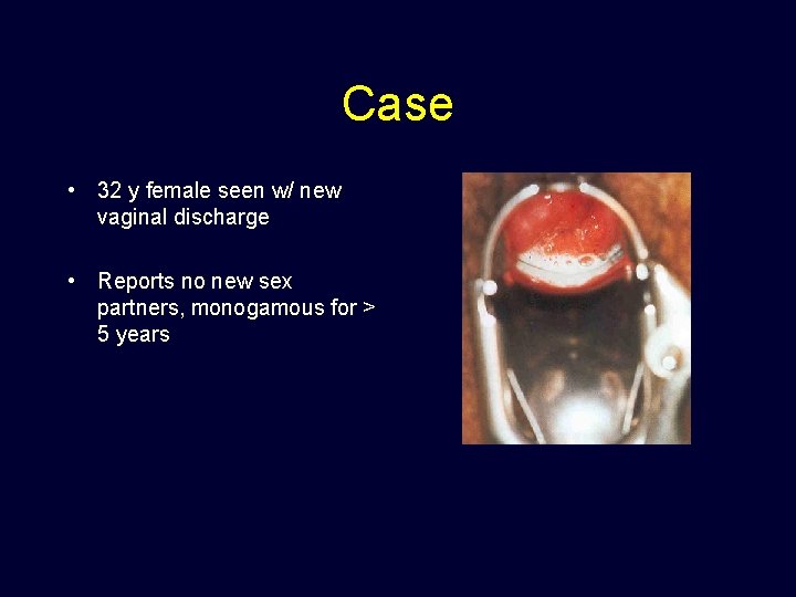 Case • 32 y female seen w/ new vaginal discharge • Reports no new