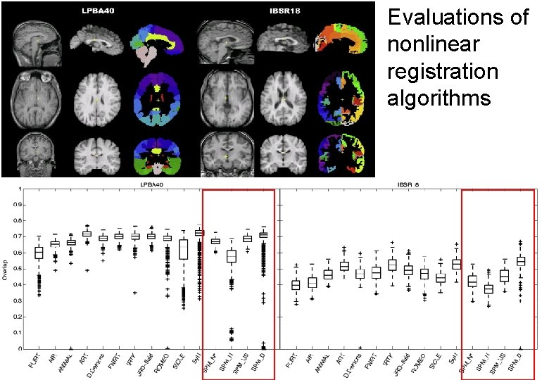 Evaluations of nonlinear registration algorithms 
