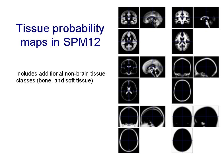 Tissue probability maps in SPM 12 Includes additional non-brain tissue classes (bone, and soft