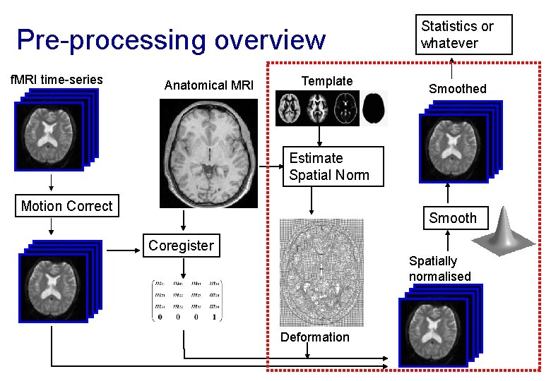 Pre-processing overview f. MRI time-series Anatomical MRI Template Statistics or whatever Smoothed Estimate Spatial