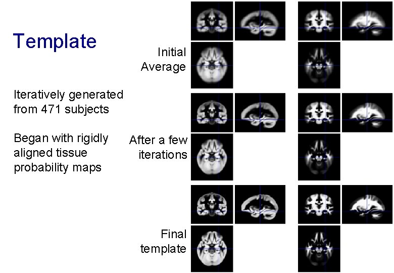 Template Initial Average Iteratively generated from 471 subjects Began with rigidly aligned tissue probability