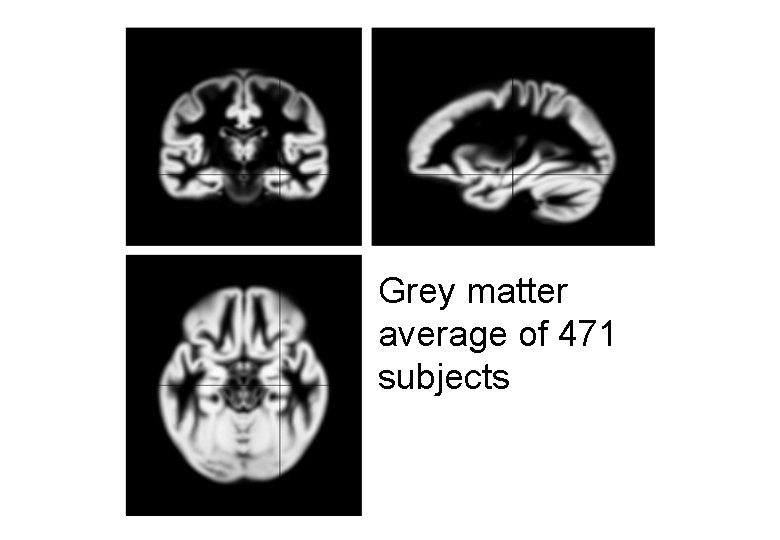 Grey matter average of 471 subjects 