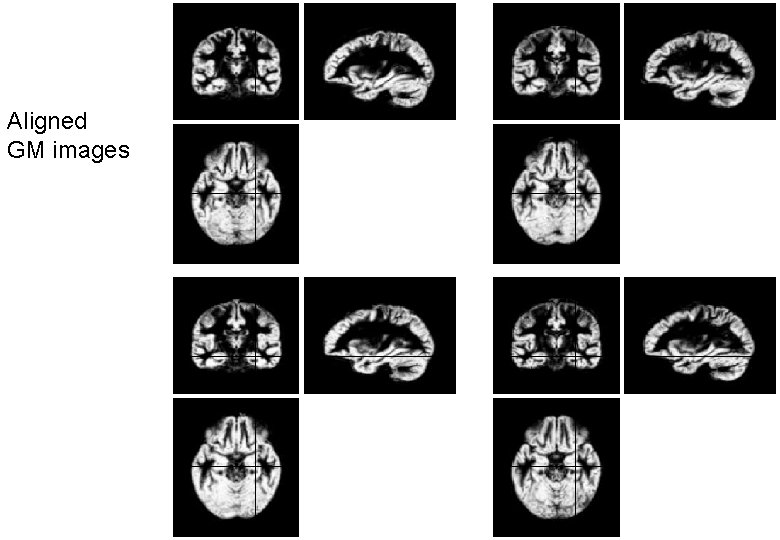 Aligned GM images 