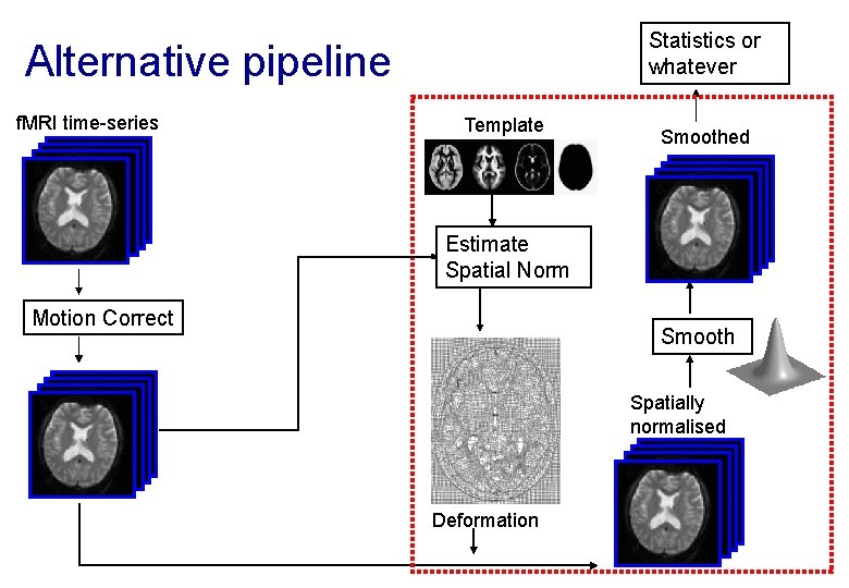 Statistics or whatever Alternative pipeline f. MRI time-series Template Smoothed Estimate Spatial Norm Motion