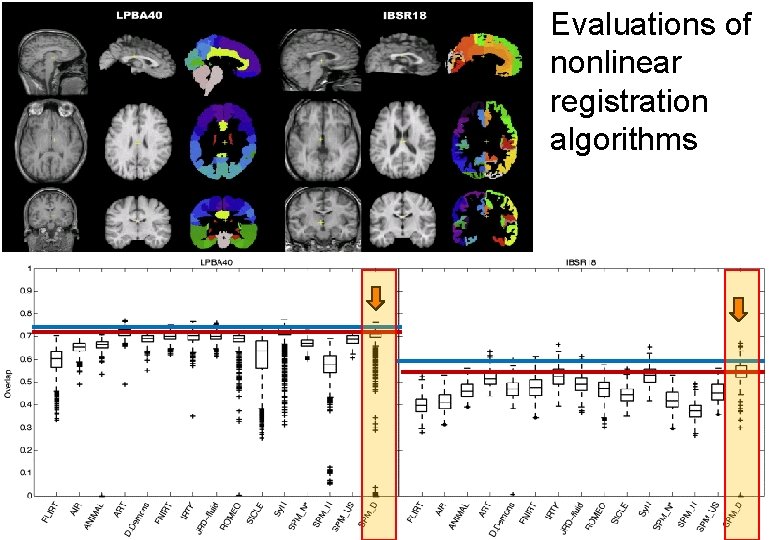 Evaluations of nonlinear registration algorithms 