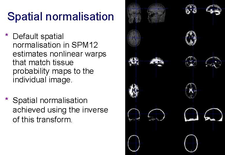 Spatial normalisation * Default spatial normalisation in SPM 12 estimates nonlinear warps that match