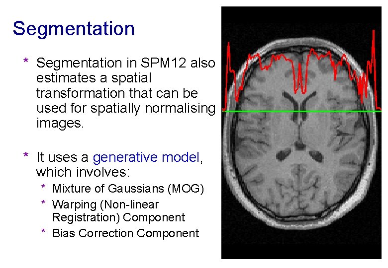 Segmentation * Segmentation in SPM 12 also estimates a spatial transformation that can be