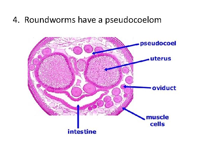 4. Roundworms have a pseudocoelom 
